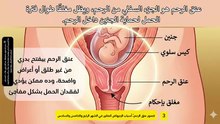 الأسباب الطبية للإجهاض في الشهور الوسطى وعلاج قصور عنق الرحم