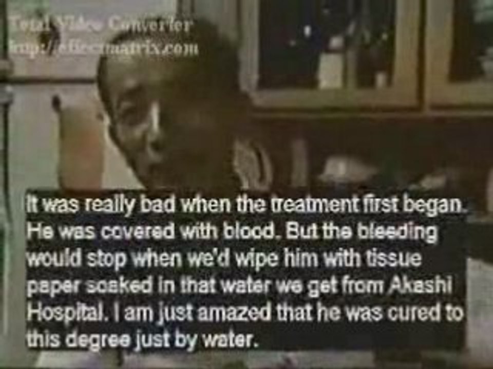 Kangen Water Eczema handling in Japanese Hospitals video Dailymotion