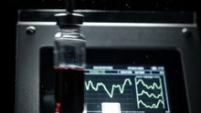 Doctors Thought It Was Just Stress... Then They Found Parasite Larvae In Her Blood! (True UK Medical Horror)