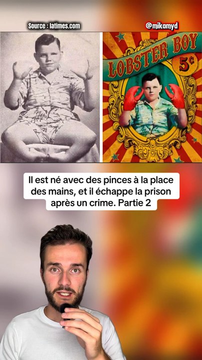 Il est né avec des pinces à la place des mains, et il échappe la prison après un crime. Partie 2
