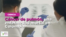 Cáncer de pulmón, una enfermedad mortal en Colombia