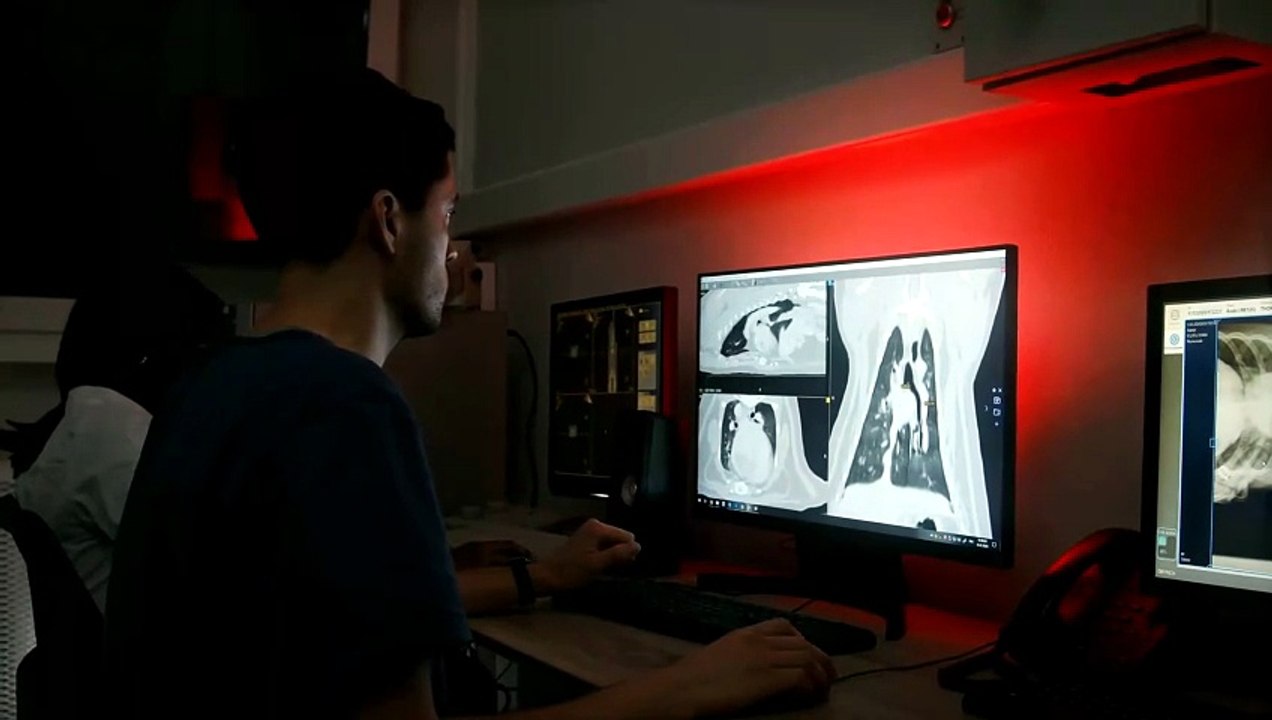 LG 31IN Medical Anti-Glare Monitor Review