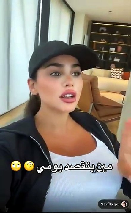 دكتورة يومي تهاجم مشهورة بعد زفافها: نسخت حفل زفافي