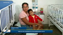 Mais de 100 atendimentos por queimaduras no HR