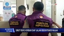 Kondisi Korban Penyekapan di Bandung, Dirut RSHS: Korban Siap Jalani Rekonstruksi Wajah