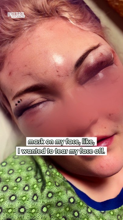 I Wanted to Tear My Face Off... - Part 1
