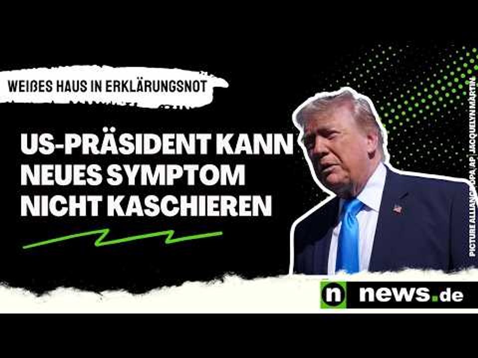 Wie krank ist Donald Trump? US-Präsident kann neues Symptom nicht kaschieren