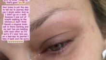 Bella Hadid lucha contra 'un grave aislamiento y una depresión grave' debido a su enfermedad de Lyme