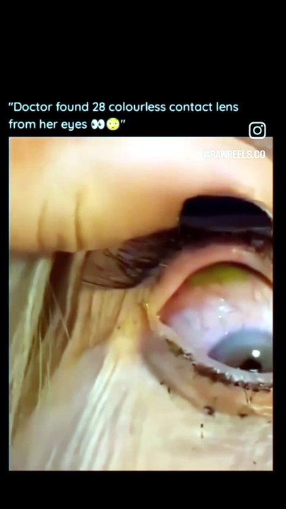 Omg 😳