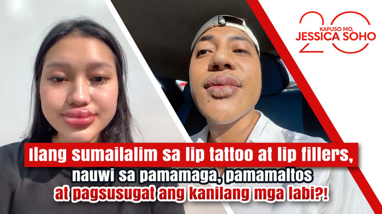 Nagpa-lip tattoo at lip fillers, namaga, namaltos at nagsugat ang labi?! | Kapuso Mo, Jessica Soho
