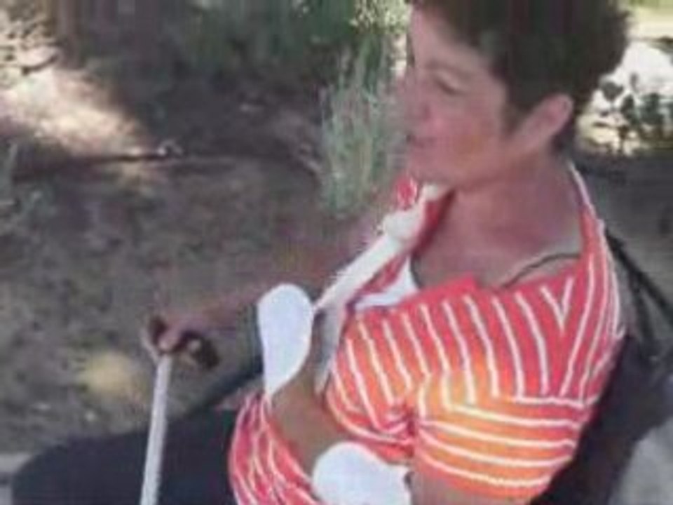 Toxine botulique, hémiplégie, et rééducation