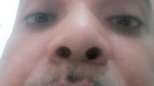 1000005567
