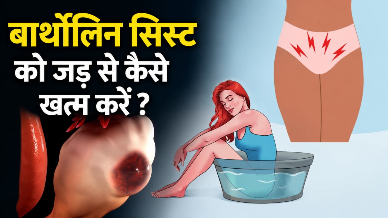Bartholin Cyst Causes: प्राइवेट पार्ट में बार बार दर्द,जलन और सूजन का कारण,इलाज |Boldsky Hindi