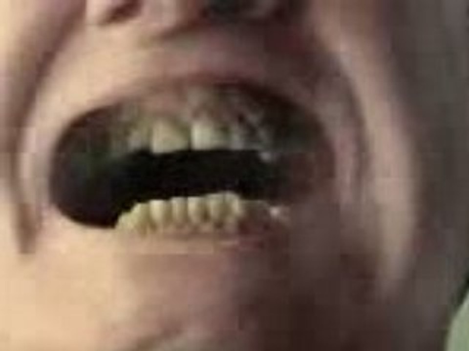 Video divertenti - Xbox