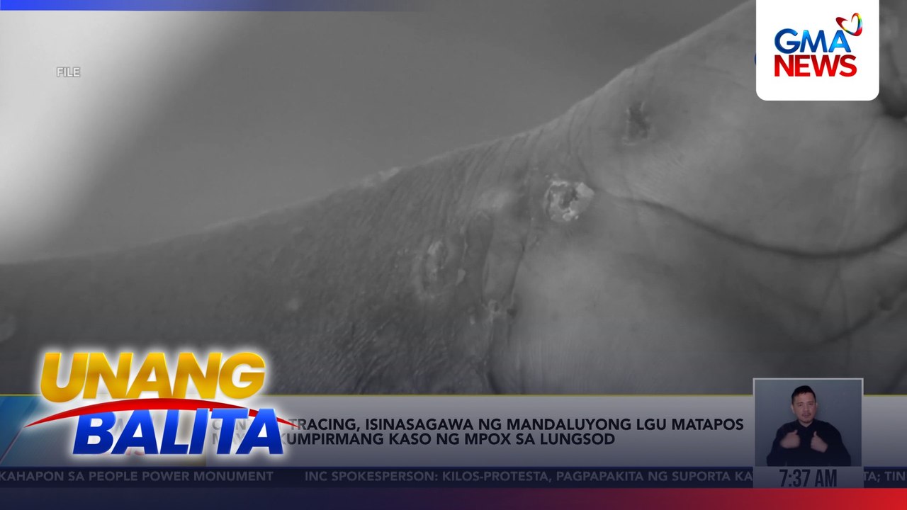 Contact tracing, isinasagawa ng Mandaluyong LGU matapos may makumpirmang kaso ng mpox sa lungsod | Unang Balita