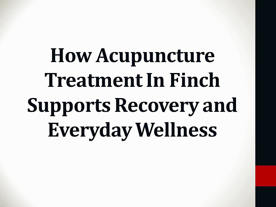 How Acupuncture Treatment In Finch Supports Recovery and Everyday Wellness