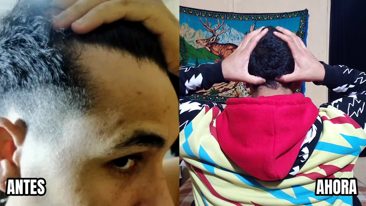 La Postura que Puede Favorecer el Crecimiento del Cabello | Ejercicio para el Cuero Cabelludo