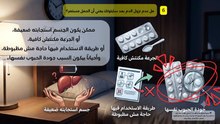 أسباب عدم حدوث نزيف بعد استخدام الميزوبرستول (السايتوتك) والخطوات الطبية الآمنة