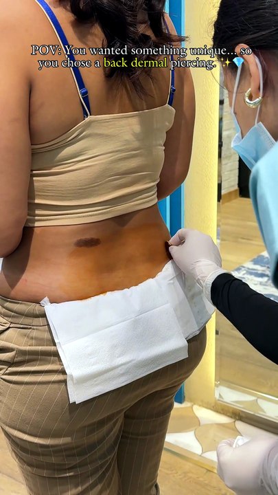 Dermals on My Back? Here's What Happened 💫#dermalpiercing #bellypiercing #daithpiercing