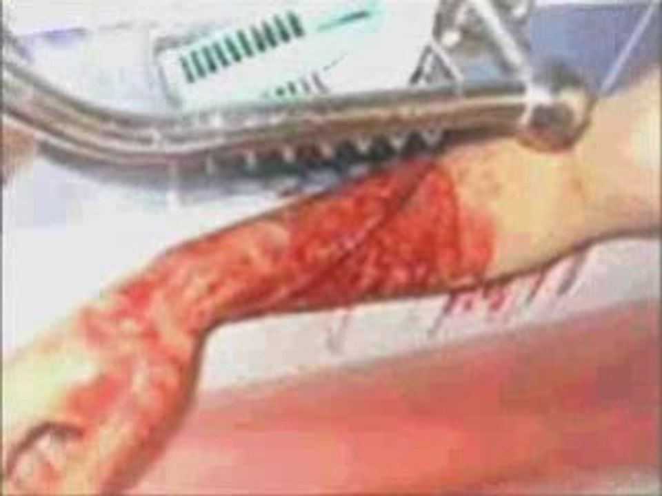 Video 2_0001