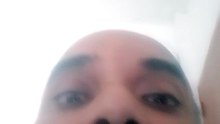 1000005715