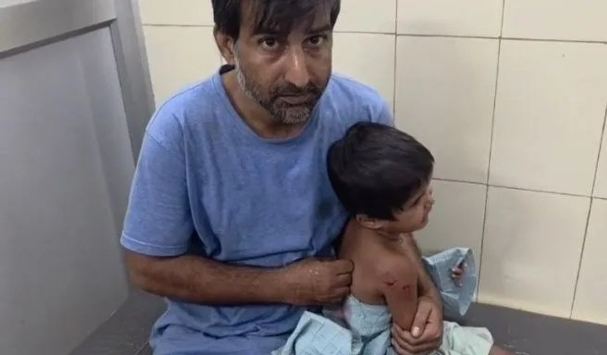 तीन वर्षीय बच्ची पर लावारिश कुत्ते ने हमला किया
