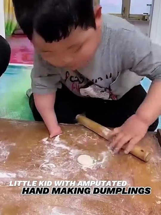 Little kid with amputated hand making dumplings!