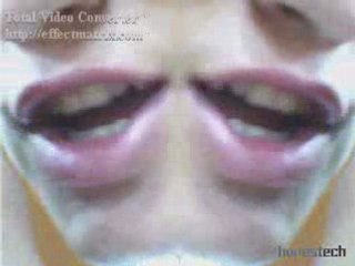 Drinlon hoxha-apologize albversion video