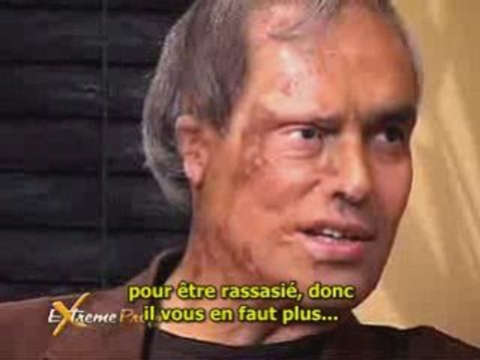 NDE - EMI  - Cet homme est mort et il est revenu