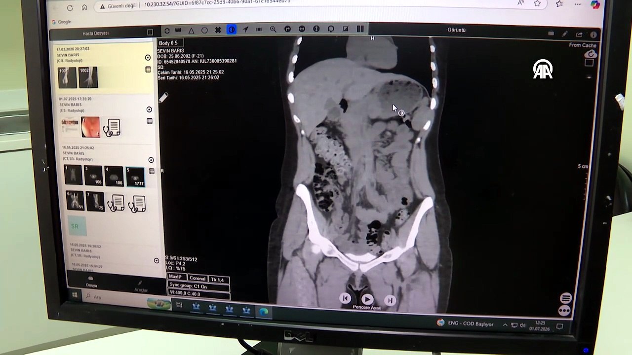 Kilo vermek uğruna öyle bir şey yaptı ki! Doktorlar şaşkına döndü