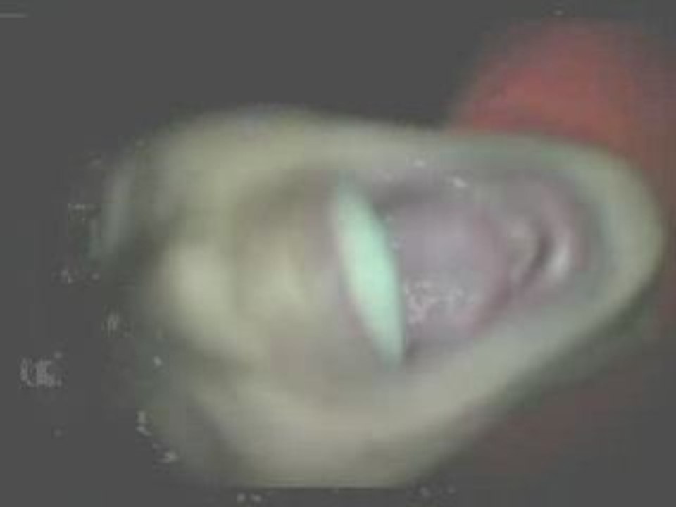 3 Tage Wach lützelkirchen 1 bei stonie