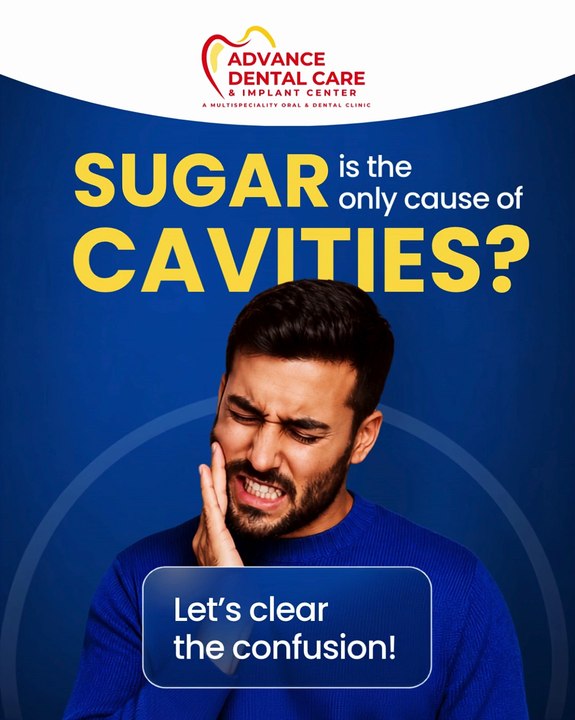 Is Sugar the Only Cause of Cavities? | Common Tooth Decay | Advance Dental Care & Implant Center