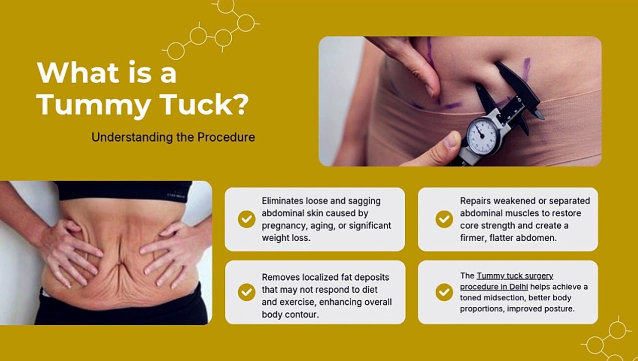 Tummy Tuck Surgery in Delhi Procedure, Recovery & Results