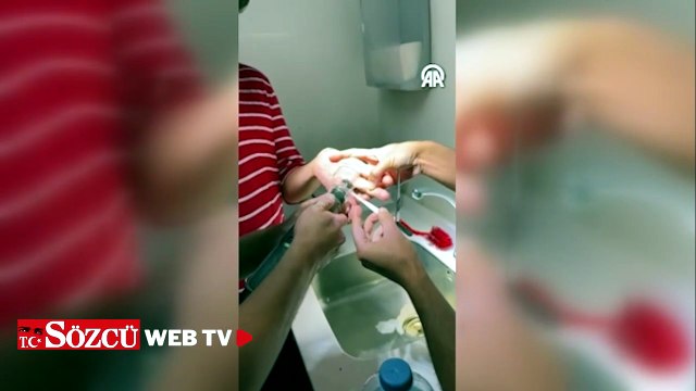 Adana'da parmakta sıkışan yüzüğü hastaneye çağrılan itfaiye çıkardı