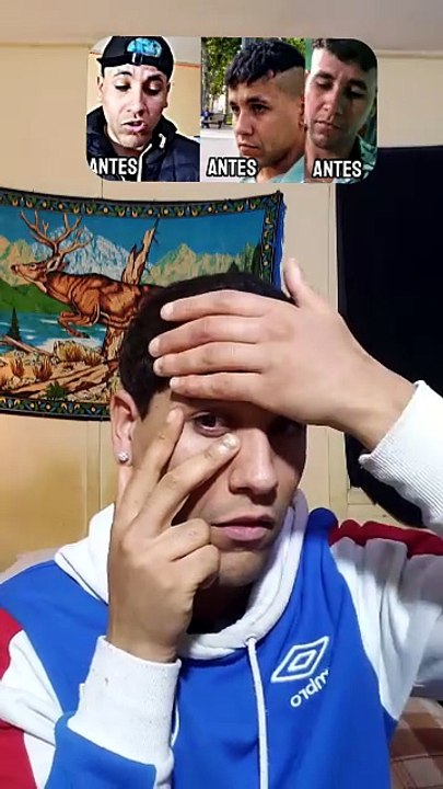 El Mejor Masaje para Bolsas, Ojeras y Arrugas de los Ojos