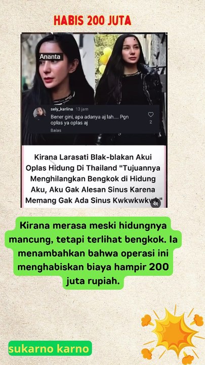 kirana larasati oplas hidung nya habis 200 juta