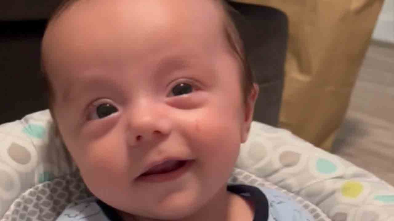 Mom brings happy baby boy on the verge of crying by roasting his hair