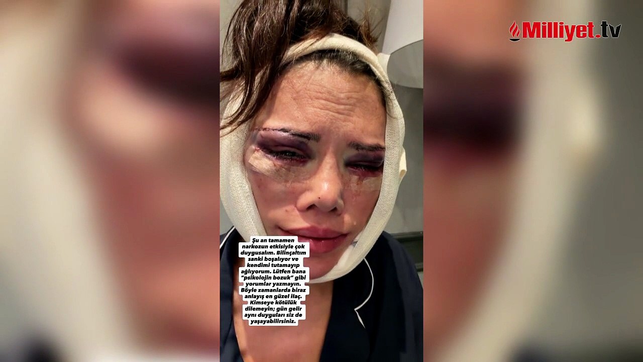 Kore’de yüz nakli olmuştu! Survivor Didem Ceran ağlayarak isyan etti: Hakkımı helal etmiyorum