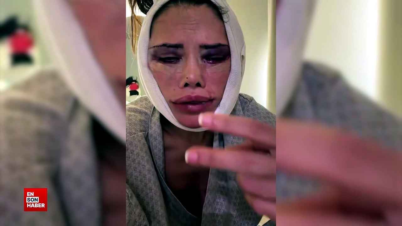 Didem Ceran ikinci kez yük nakli oldu! Doktorları şikayet edeceğim
