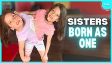 Our Conjoined Twins Refuse To Be Separated | BORN DIFFERENT