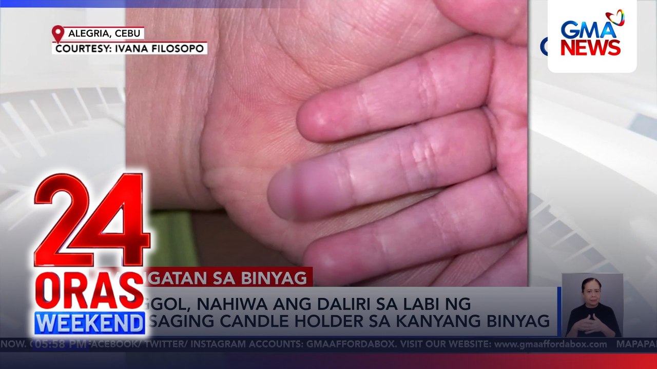 Sharp lip of glass candle holder injures baby in baptism | 24 Oras Weekend