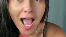 1000088657