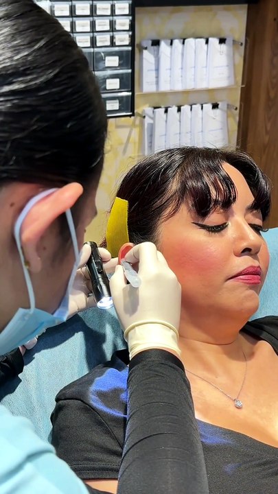 My Helix Piercing Journey: From Fresh Needle to Healed Beauty ✨ #helixpiercing #traguspiercing