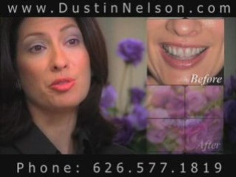 Porcelain Veneers Specialist Los Angeles and Pasadena