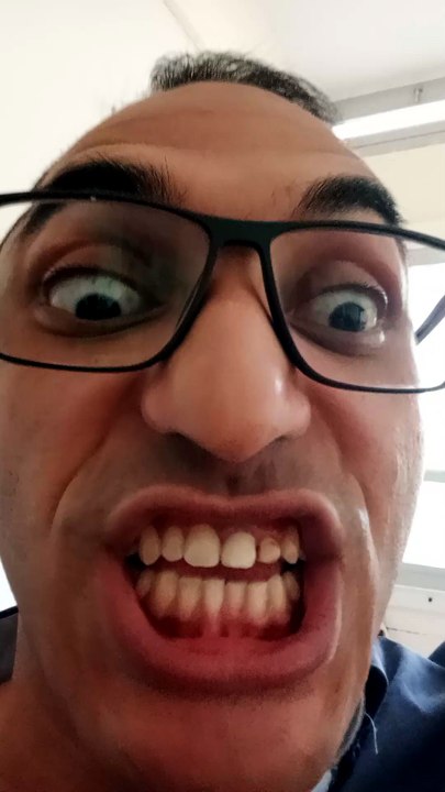 freacky face funny shorts
