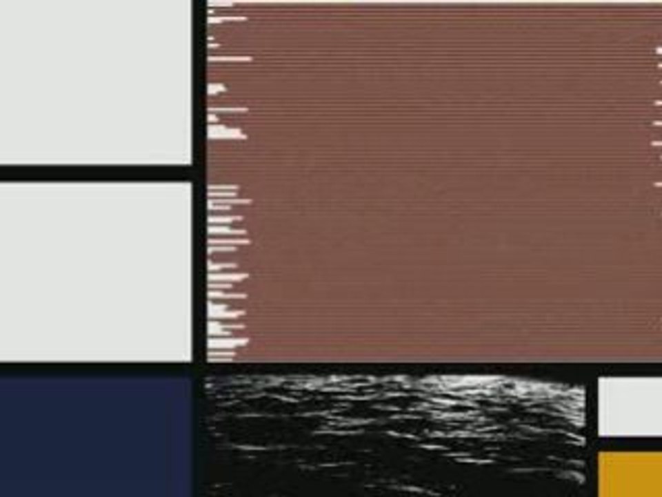 Composition-1