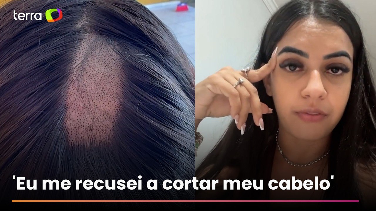 Mulher denuncia laboratório na PB após ter parte da cabeça raspada em exame toxicológico para CNH