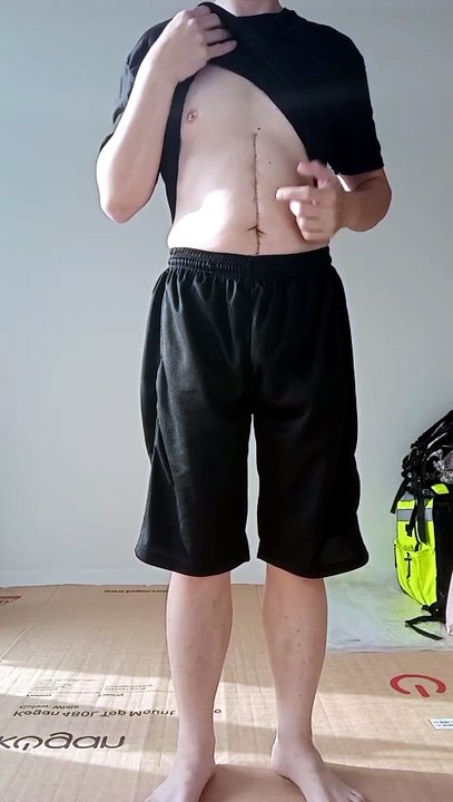 【Day 008】After Cancer & Total Stomach Removal|500 Gratitude Punches 4 Body Recovery HXH Netero Style