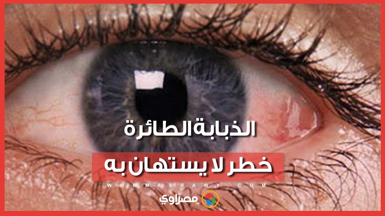 الذبابة الطائرة خطر لا يستهان به.. الدكتور إيهاب سعد أستاذ العيون بجامعة القاهرة يكشف تفاصيل مرض يصيب العيون