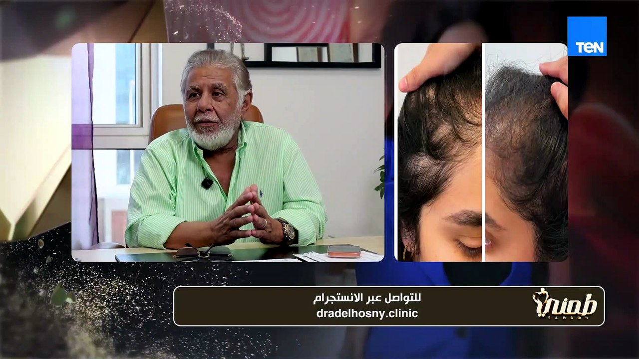 ما هو علاج الشعر بالاكسوزوم وهل هو علاج طبي فعال يمنع تساقط الشعر؟ د. عادل حسني يجيب
